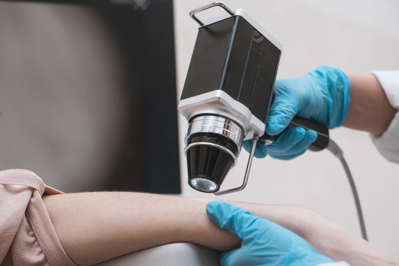 Дерматолог перечислила главные признаки меланомы